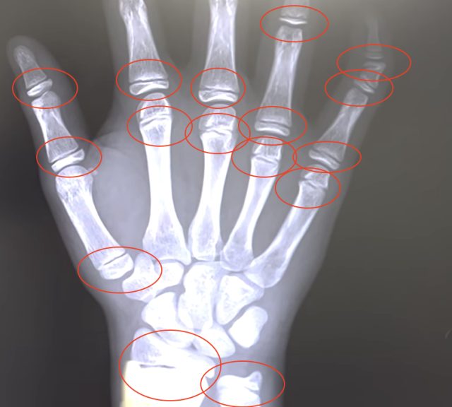 厳しい話も包み隠さず全部伝え、可能性があれば治療を提案